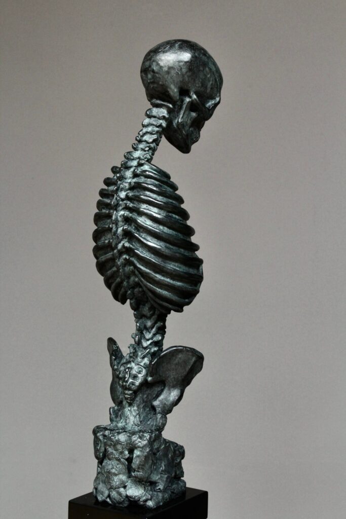 3 Masses Skeleton back